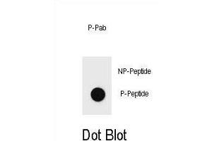 Dot blot analysis of Phospho-BAD-Y76 Antibody Phospho-specific Pab j on nitrocellulose membrane. (BAD Antikörper  (pTyr76))