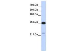 Image no. 1 for anti-TP53 Target 5 (TP53TG5) (AA 143-192) antibody (ABIN6741254) (TP53TG5 Antikörper  (AA 143-192))