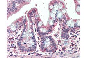 Anti-EML5 antibody IHC staining of human small intestine.