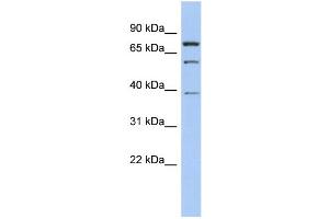 WB Suggested Anti-MOSPD2 Antibody Titration: 0. (MOSPD2 Antikörper  (Middle Region))