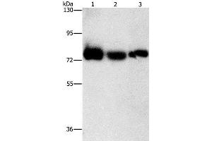 Western Blot analysis of Human fetal muscle tissue, K562 and hela cell using AMPD1 Polyclonal Antibody at dilution of 1:1600 (AMPD1 Antikörper)