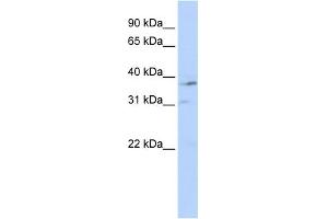 Western Blotting (WB) image for anti-Nuclear Receptor Subfamily 1, Group I, Member 3 (NR1I3) (Middle Region) antibody (ABIN2782286)