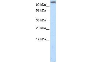 WB Suggested Anti-MKL1 Antibody Titration:  1.