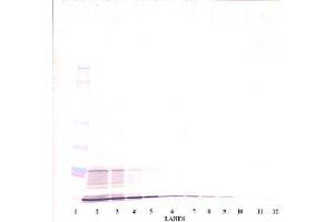 Image no. 2 for anti-Interleukin 15 (IL15) antibody (ABIN464931) (IL-15 Antikörper)