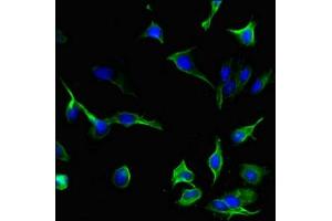 Immunofluorescent analysis of Hela cells using ABIN7156895 at dilution of 1:100 and Alexa Fluor 488-congugated AffiniPure Goat Anti-Rabbit IgG(H+L) (IL-33 Antikörper  (AA 123-276))