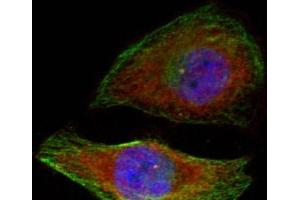 Immunofluorescence analysis of methanol-fixed HeLa cells showing cytoplasmic, nuclear staining using Phospho-MAPK3(T202) Polyclonal Antibody (ERK1 Antikörper  (pThr202))