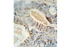 Immunohistochemistry (Paraffin-embedded Sections) (IHC (p)) image for anti-Glucosaminyl (N-Acetyl) Transferase 2, I-Branching Enzyme (I Blood Group) (GCNT2) (AA 371-399), (C-Term) antibody (ABIN952480)