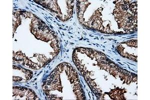 Immunohistochemistry (IHC) image for anti-Amyloid beta (A4) Precursor Protein (APP) antibody (ABIN1496876) (APP Antikörper)
