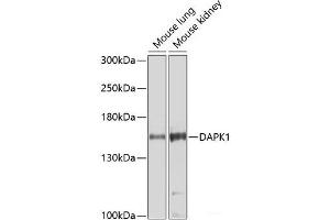 Western blot analysis of extracts of various cell lines using DAPK1 Polyclonal Antibody at dilution of 1:1000. (DAP Kinase 1 Antikörper)