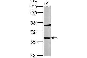 WB Image Sample (30 ug of whole cell lysate) A: IMR32 7.