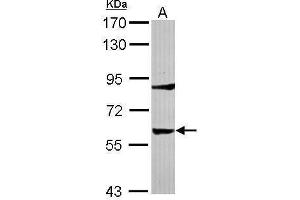 WB Image Sample (30 ug of whole cell lysate) A: IMR32 7. (Tyrosine Hydroxylase Antikörper)