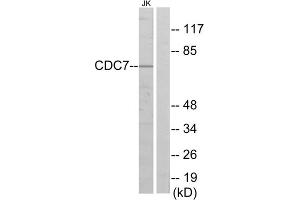 Western blot analysis of extracts from Jurkat cells, using CDC7 antibody. (CDC7 Antikörper  (N-Term))