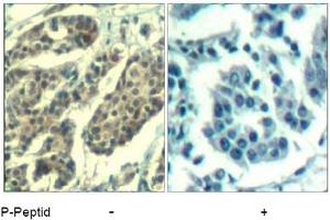 Image no. 1 for anti-Cyclin B1 (CCNB1) (pSer147) antibody (ABIN401595) (Cyclin B1 Antikörper  (pSer147))
