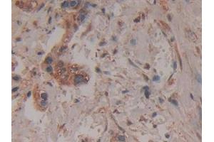 Immunohistochemistry (IHC) image for anti-Leukocyte Immunoglobulin-Like Receptor, Subfamily B (With TM and ITIM Domains), Member 2 (LILRB2) (AA 53-255) antibody (ABIN7444112)