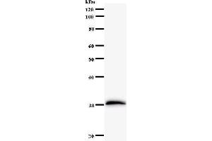 Western Blotting (WB) image for anti-Forkhead Box L2 (FOXL2) antibody (ABIN931144) (FOXL2 Antikörper)