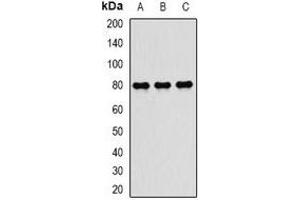 Western Blotting (WB) image for anti-Transporter 2, ATP-Binding Cassette, Sub-Family B (MDR/TAP) (TAP2) antibody (ABIN7305990)