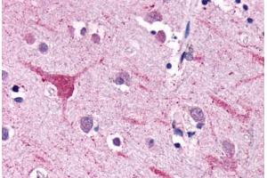 Anti-NPFFR2 antibody  ABIN1049116 IHC staining of human brain, neurons and glia.