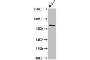 Western Blot Positive WB detected in: MCF-7 whole cell lysate All lanes: PSD antibody at 3. (PSD Antikörper  (AA 247-489))
