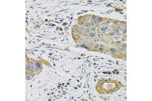 Immunohistochemistry (Paraffin-embedded Sections) (IHC (p)) image for anti-Keratin 20 (KRT20) (AA 245-424) antibody (ABIN3020782)