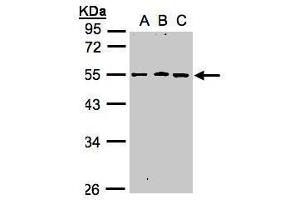 WB Image Sample(30 ug whole cell lysate) A:A431, B:H1299 C:HeLa S3, 10% SDS PAGE antibody diluted at 1:1000 (RGMB Antikörper  (Center))