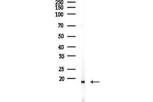 Western blot analysis of lysates from F10-LUC cells(heat-shock 45 min treatment), using Di-Methyl-Histone H3 (Lys27)/H3K27me2 Antibody at 1/1000 dilution.