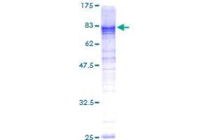 Image no. 1 for L(3)mbt-Like 4 (L3MBTL4) (AA 1-534) protein (GST tag) (ABIN1309102)