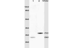 Lane 1: rat brain lysates Lane 2: human colon carcinoma lysates probed with Anti CPSF4/CPSF30 Polyclonal Antibody, Unconjugated (ABIN1386751) at 1:200 in 4 °C. (CPSF4 Antikörper  (AA 81-180))