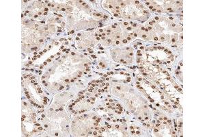 ABIN6267347 at 1/200 staining human kidney tissue sections by IHC-P. (Histone H2A Antikörper  (pThr121))