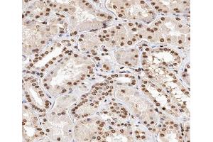 ABIN6267347 at 1/200 staining human kidney tissue sections by IHC-P.