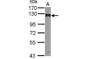 WB Image Sample (30 ug of whole cell lysate) A: A549 7. (Calpastatin Antikörper)