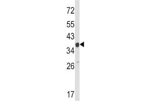 Western Blotting (WB) image for anti-Actin Related Protein 2/3 Complex, Subunit 1A, 41kDa (ARPC1A) antibody (ABIN3002659) (ARPC1A Antikörper)