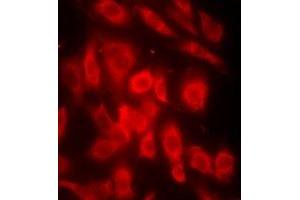Immunofluorescent analysis of OMI staining in MCF7 cells.