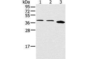 Western blot analysis of Jurkat Hela and 231 cell using CCNG1 Polyclonal Antibody at dilution of 1:400 (Cyclin G1 Antikörper)