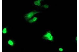 Image no. 3 for anti-T-Cell Acute Lymphocytic Leukemia 1 (TAL1) antibody (ABIN1501288) (TAL1 Antikörper)