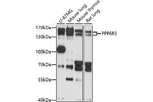 Western blot analysis of extracts of various cell lines, using PPP6R3 antibody (ABIN7269694) at 1:1000 dilution. (PPP6R3 Antikörper  (AA 1-260))
