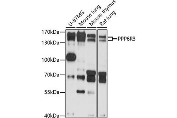 PPP6R3 Antikörper  (AA 1-260)