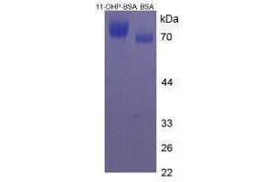 Image no. 1 for 11-Hydroxyprogesterone peptide (BSA) (ABIN5665929)