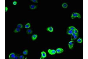 Immunofluorescent analysis of A431 cells using ABIN7168723 at dilution of 1:100 and Alexa Fluor 488-congugated AffiniPure Goat Anti-Rabbit IgG(H+L) (SCAMP2 Antikörper  (AA 1-153))