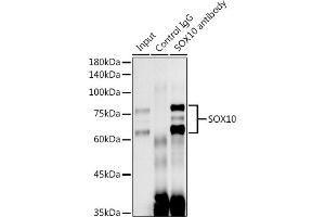 Immunoprecipitation analysis of 300 μg extracts of C6 cells using 3 μg SOX10 antibody (ABIN7270567).