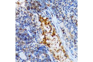 Immunohistochemistry of paraffin-embedded mouse spleen using T Rabbit mAb (ABIN7270916) at dilution of 1:100 (40x lens). (TACC3 Antikörper)