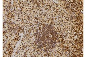 ABIN6277651 at 1/100 staining Rat spleen tissue by IHC-P. (MTR4 Antikörper  (Internal Region))
