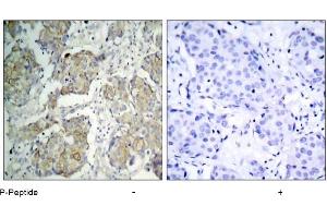 Image no. 3 for anti-VEGF Receptor 2 (VEGFR2) (pTyr1214) antibody (ABIN196768) (VEGFR2/CD309 Antikörper  (pTyr1214))