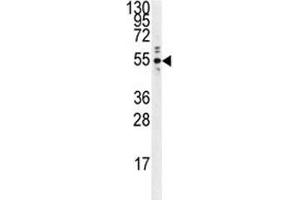 Western blot analysis of PTP1B antibody and Ramos lysate. (PTPN1 Antikörper)