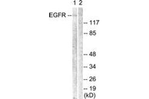 Western blot analysis of extracts from Jurkat cells, using EGFR (Ab-1069) Antibody. (EGFR Antikörper  (AA 1031-1080))