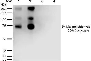 Western Blot analysis of Malondialdehyde-BSA Conjugate showing detection of 67 kDa Malondialdehyde -BSA using Mouse Anti-Malondialdehyde Monoclonal Antibody, Clone 11E3 . (Malondialdehyde Antikörper  (FITC))