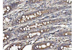 IHC analysis of CLPB using anti-CLPB antibody (ABIN7601732).