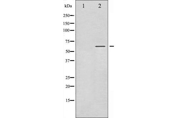 SGK1 Antikörper  (pSer422)