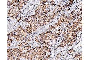 IHC analysis of Hexokinase 1/HK1 using anti-Hexokinase 1/HK1 antibody (ABIN7600260). (Hexokinase 1 Antikörper  (AA 17-323))