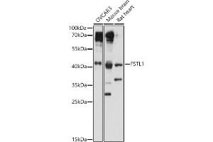 Western blot analysis of extracts of various cell lines, using FSTL1 antibody (ABIN7267227) at 1:1000 dilution. (FSTL1 Antikörper  (AA 1-308))
