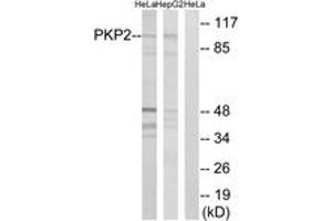 Western blot analysis of extracts from HeLa/HepG2 cells, using PKP2 Antibody. (Plakophilin 2 Antikörper  (AA 632-681))